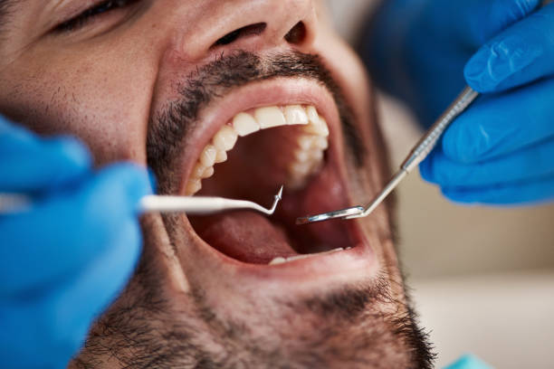 Professional Dental Services in Madison Park, NJ